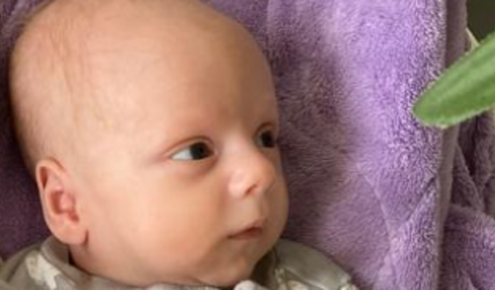 CIRURGIA OLHOS JOAQUIM GOMES SAVOLDI