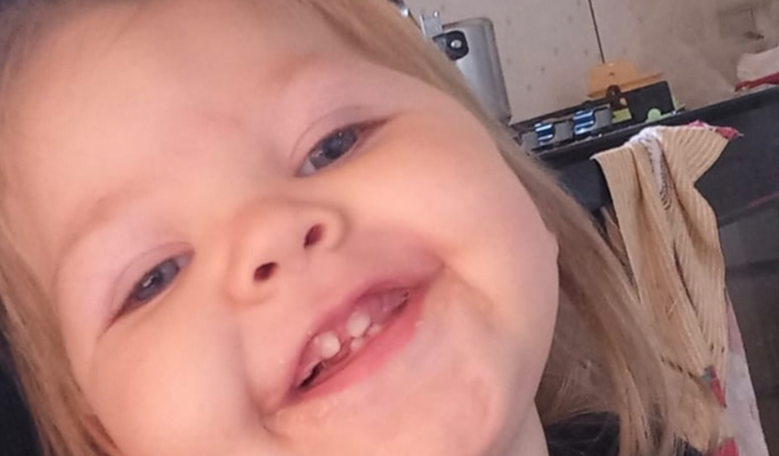 Ajude a Laurinha a realizar seu exame (ELETROENCEFALOGRAMA)