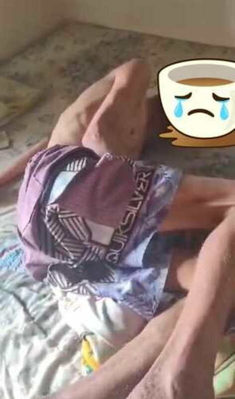 Vaquinha em prol de tratamento de ERISIPELA E CÂNCER DE PELE