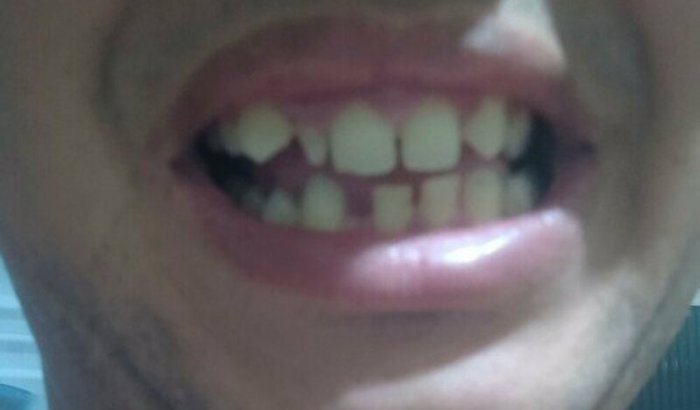 Ajuda para arrumar meus Dentes