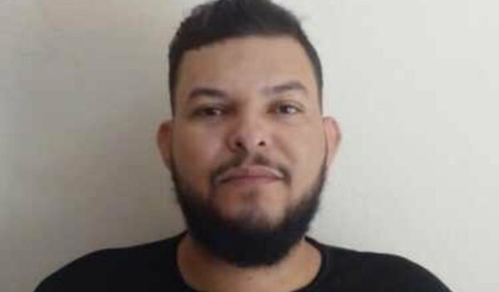 Cirurgia rinossinusite fúngica maxiloetmoidal a direita.