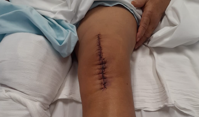 Ajudem para terminar de pagar uma cirurgia 