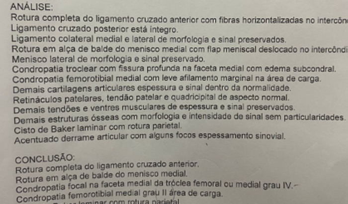 Cirurgia Joelho Direito - Lca e Menisco