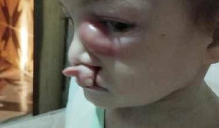 Ajudem minha Filha Lorena Sophia 😞😞😞