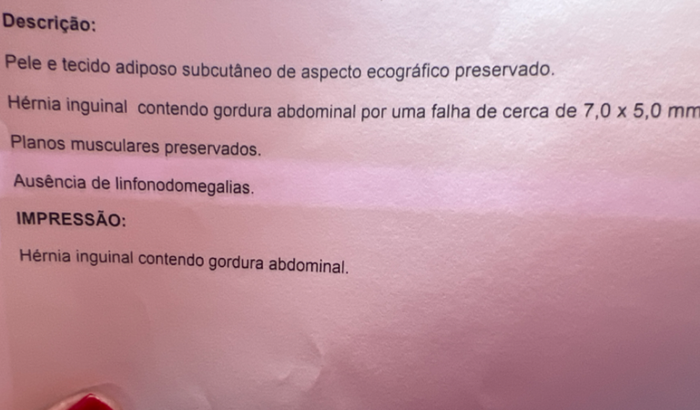 Cirurgia para minha filha de 5 anos  Hérnias inguinal 