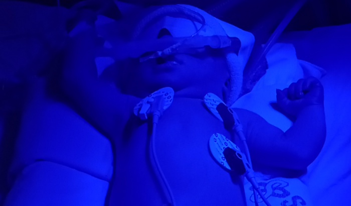 Ajude no tratamento de meu netinho Ravi, todos juntos por ravi 