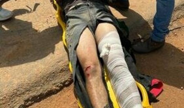 Preciso de ajuda tive um acidente