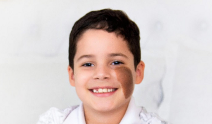 Avaliação de neuropsicólogo  para meu Miguel