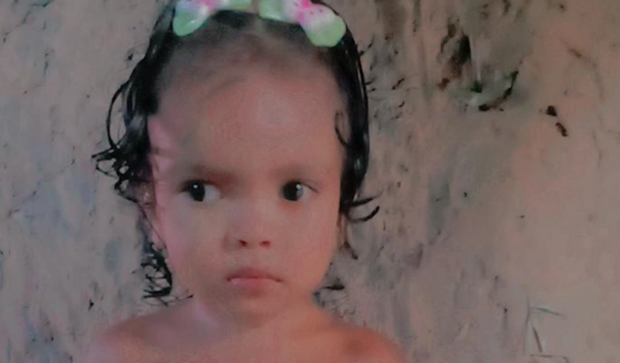Consulta para minha filha que tem problema na vista de 1 aninho 