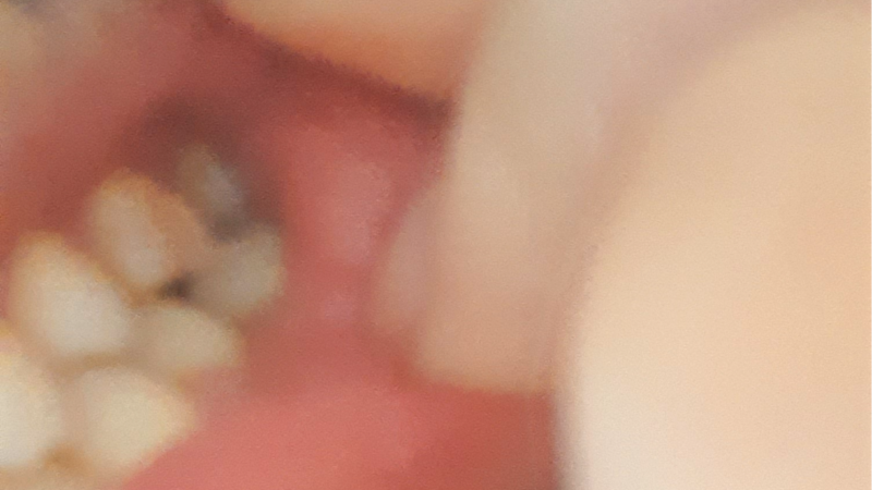 Arruma meu dente