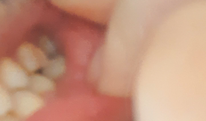 Arruma meu dente