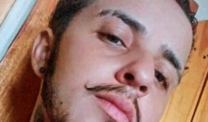 Mastectomia do Chris 