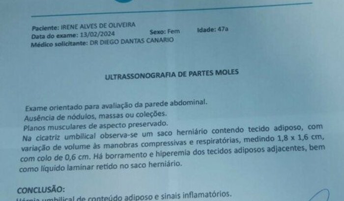 Cirurgia de Hérnia Umbilical 
