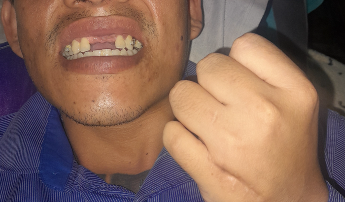 Fazer tratamento bucal botabmeus dentes