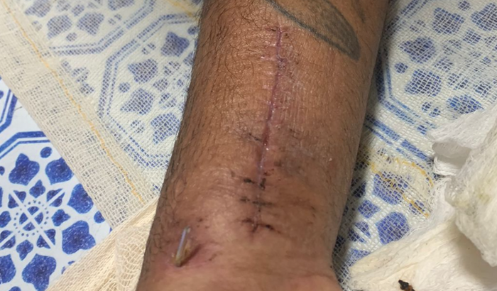 Fisioterapia de Livinho 