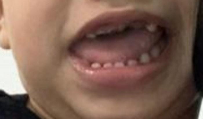 AJUDE O GUSTAVO A RECONSTRUIR OS DENTINHOS