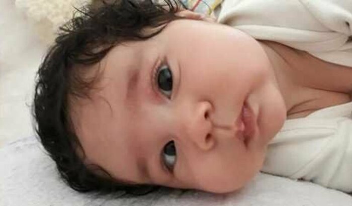 Bella♡Princesa   *Estrabismo*