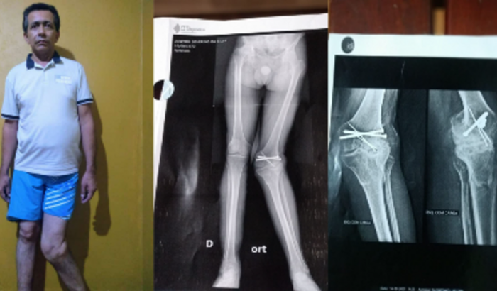 Ajude Josemir a fazer a cirurgia no joelho