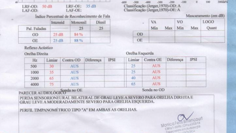 Meryluci Oliveira  - Aparelho Auditivo 