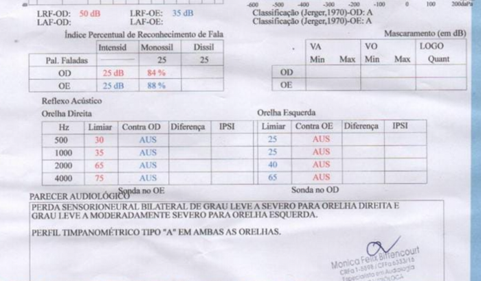 Meryluci Oliveira  - Aparelho Auditivo 