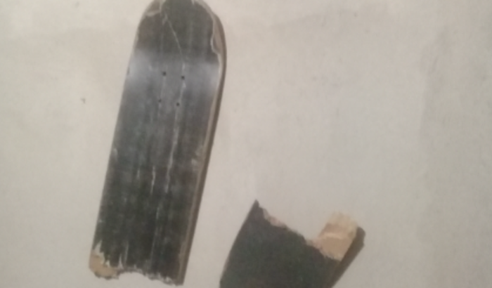 Sem empregos na cidade uso skate contra a ansiedade, quebrou 