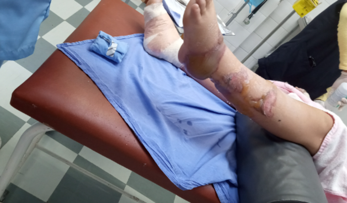 Recuperação pós incêndio