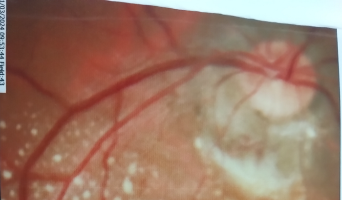 Uma mão amiga para Ana voltar enxergar