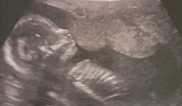 Bolão da Aeliana - Data de Nascimento