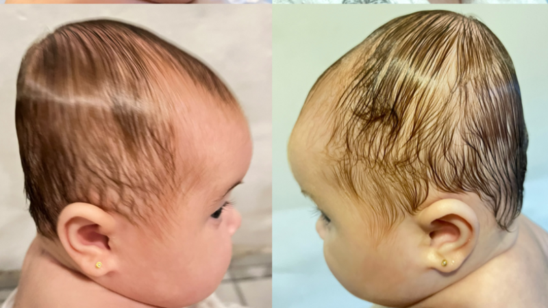 Ajude no tratamento da Ana Liz 