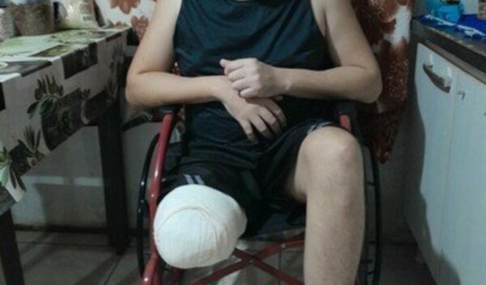 Me ajudem a colocar a prótese...