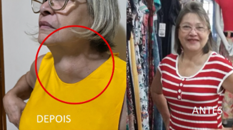 "Vencendo o Câncer da Rita"