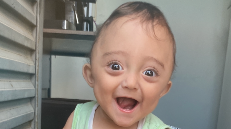 Ajude Miguelzinho a vencer a cranioestenose