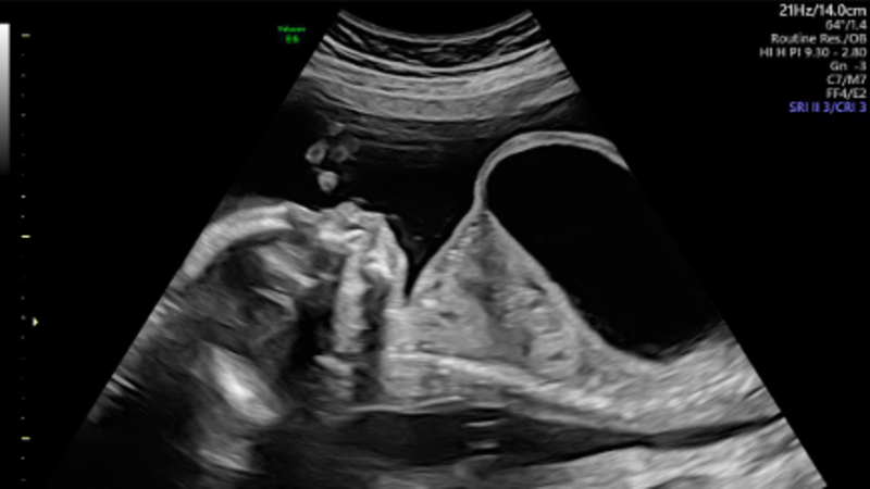 Campanha um futuro para o Otto ❤️