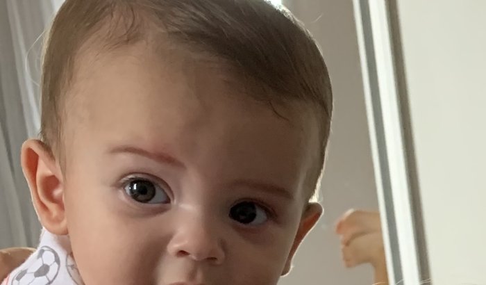 Tratamento Braquicefalia Israel