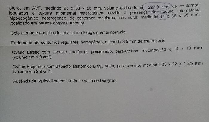 Cirurgia para retirar o mioma no útero