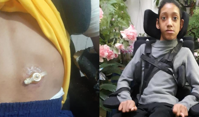 Ajuda para comprar a sonda via alimentação boton (GTT)