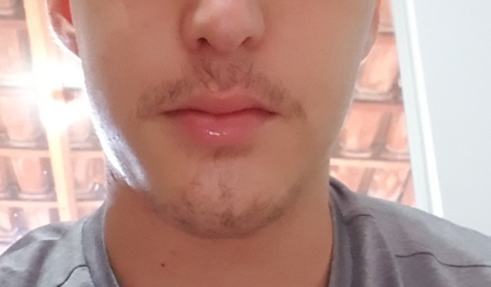 Custo com o tratamento de câncer