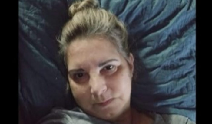 Ajude a minha mãe na retirada de rim com falência renal