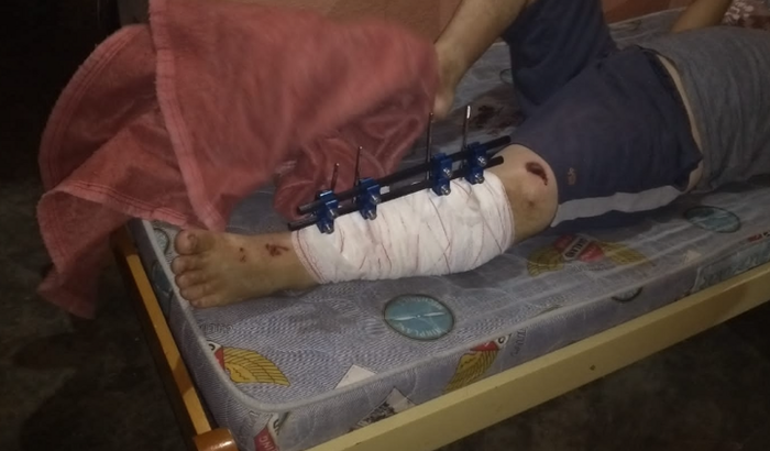 Ajuda para Silvana , mãe do Alex