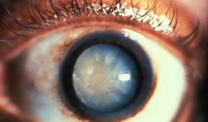 Cirurgia