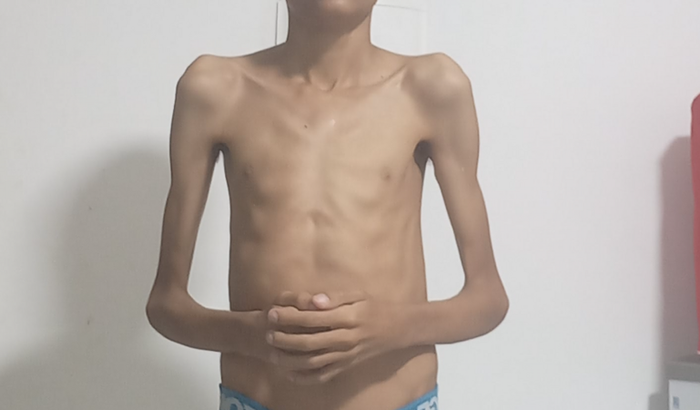 Ajuda para comprar suplementos em falta pelo governo de Pernambuco