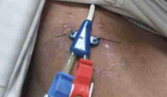 AJUDE UM RENAL CRÔNICO. 🙏