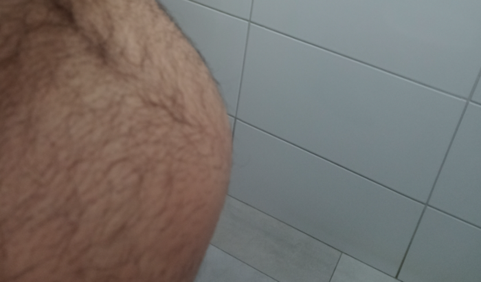 Ajuda para fazer uma cirurgia de hérnia