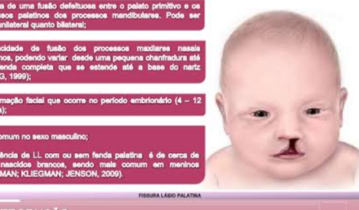 Uma mão amiga pra minha amiga Campanha do bem Maria Luiza