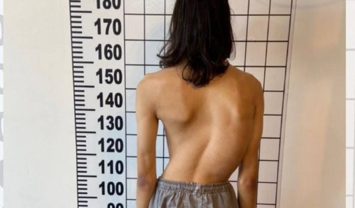 Ajude na cirurgia do Fe