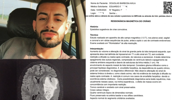 Ajude Douglas a vencer o tumor cerebral