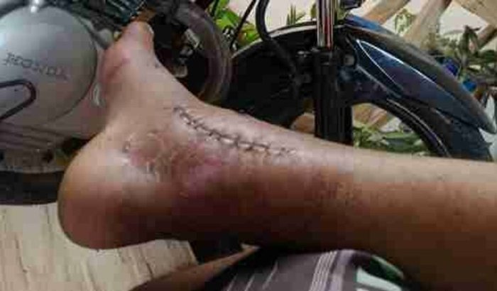 Ajuda a comprar alimentos 