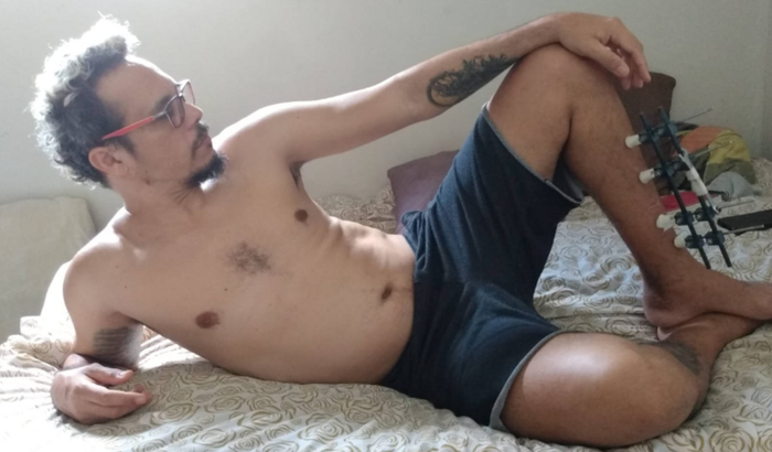 Ajude Franklin que sofre da deficiência de S.P (Sempre Liso)