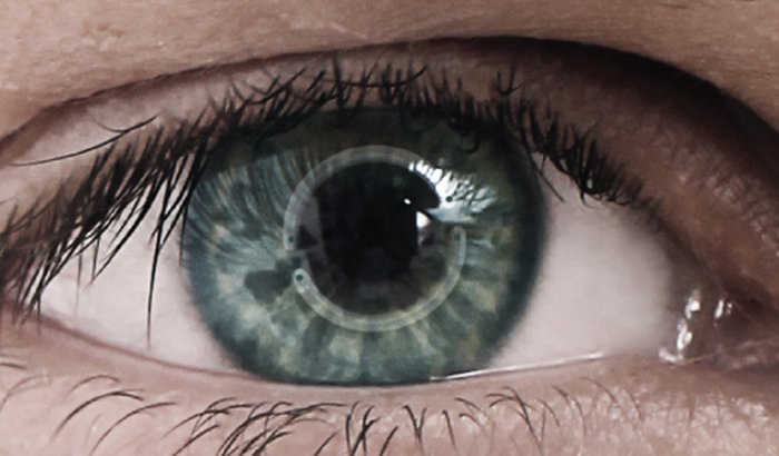 Cirurgia Ocular - Dhionatan