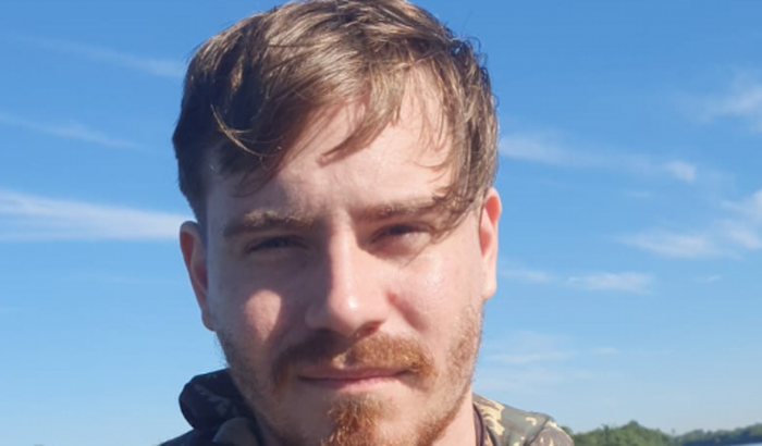 Implante capilar dos sonhos